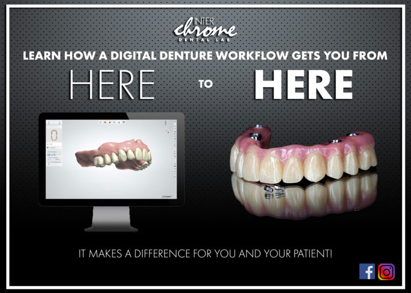 digital denture workflow inter-chrome dental