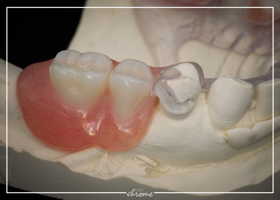 Clasp assembly and acrylic