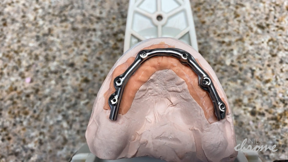 Milled titanium bar ready for teeth