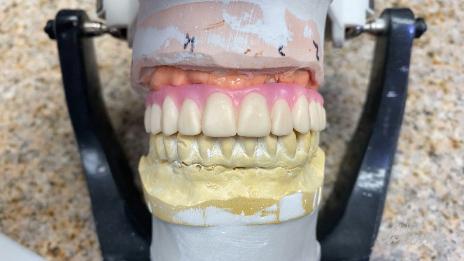 Waxed up printed prototype on top of bar