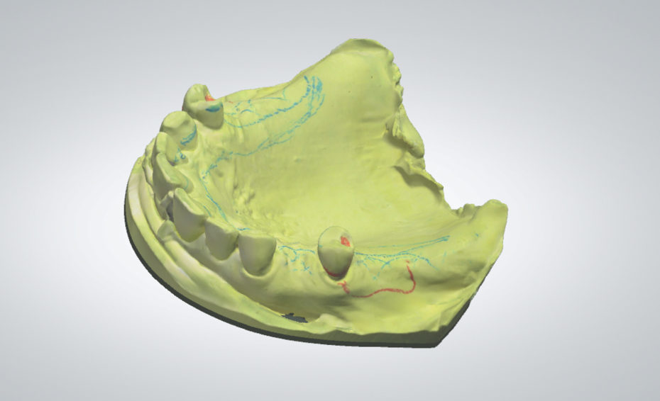scan of analog master model