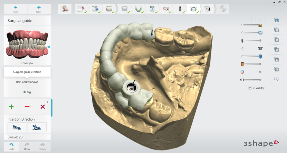 Surgical Guide - Screenshot 01