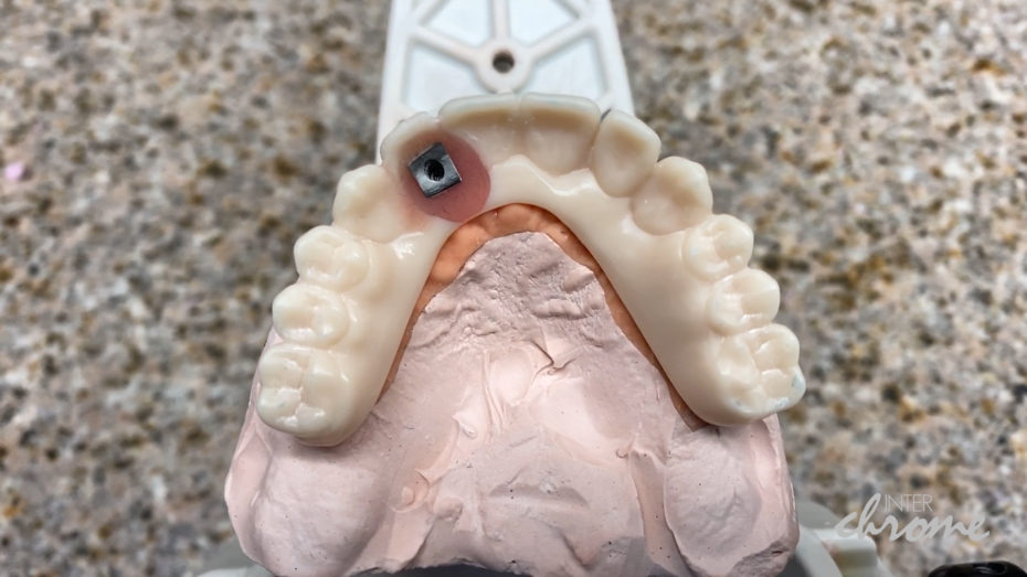 Screw retained printed prototype